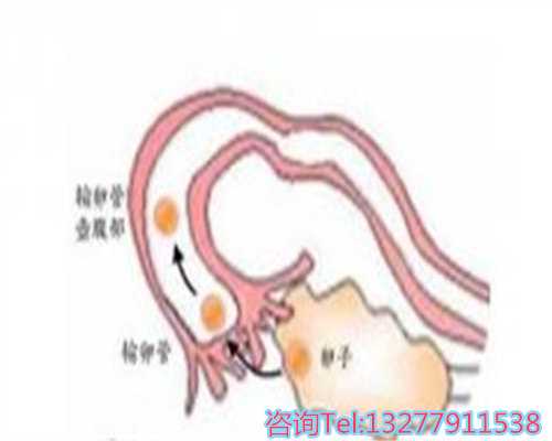 孕妇喝的鲫鱼汤应该如何炖
